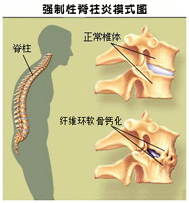 核心症状解析